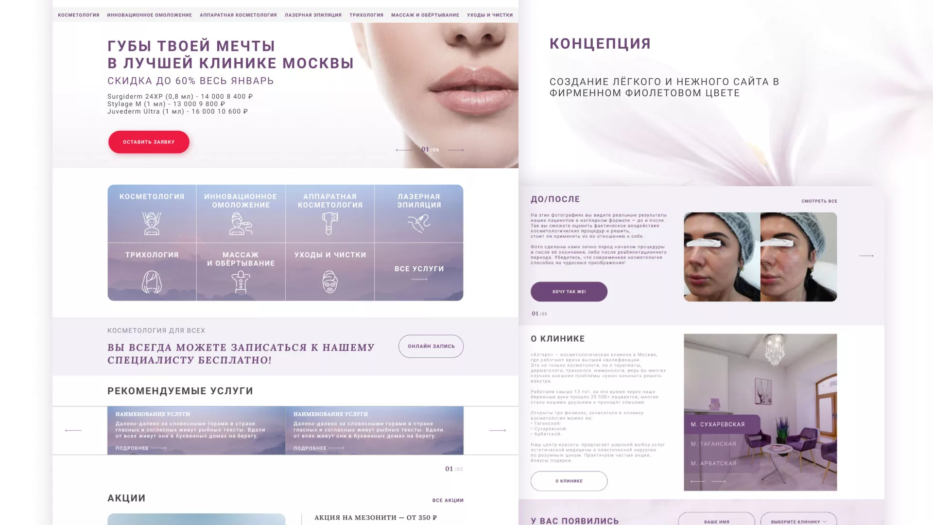 Создание сайта сети клиник эстетической косметологии «Алтеро» в Ивделе